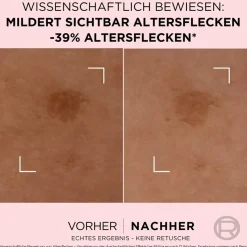 Lu2019Oru00E9al Paris Age Perfect Golden Age Anti-Altersflecken Fluid von L’Oréal Paris Sale