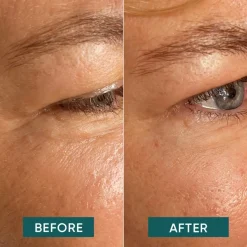 APRICOT Augen - Schläfen Pads - aloe there von