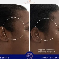 Augustinus Bader The Scalp Treatment