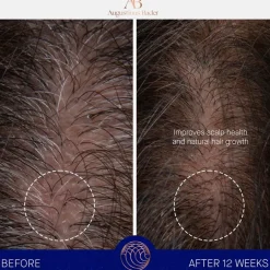 Augustinus Bader The Scalp Treatment
