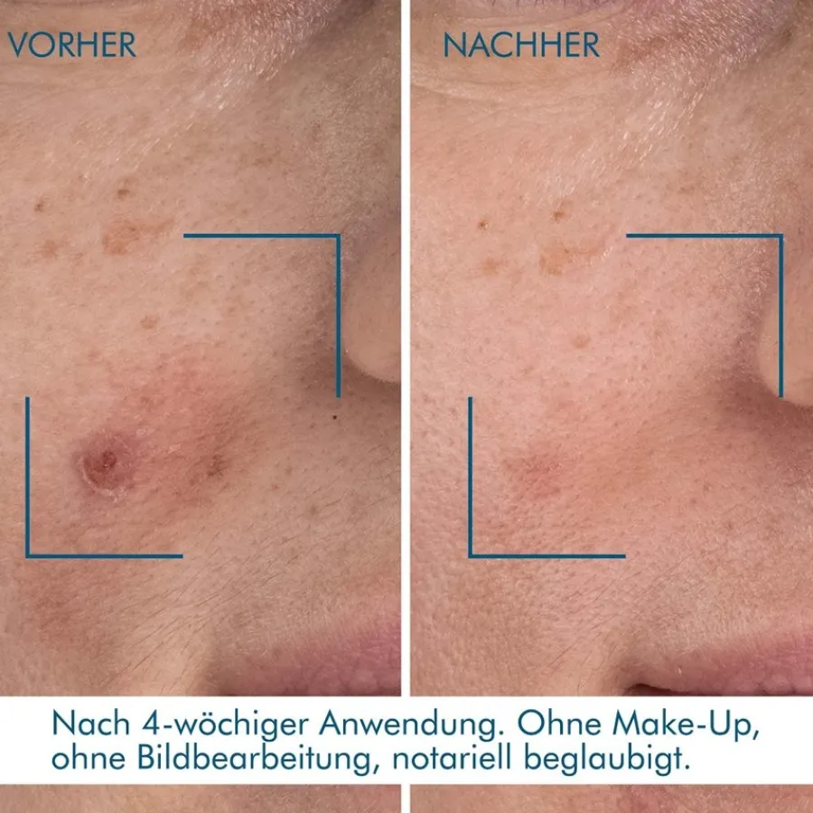 Biotherm Blue Therapy Blue Retinol Resurface + Repair Night Serum von