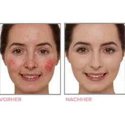 it Cosmetics Bye Bye Neutralizing Correcting Cream Bye Bye Redness von Sale