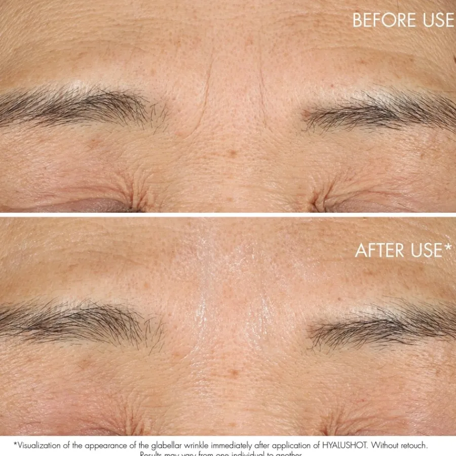 DIOR Capture Totale Hyalushot von Outlet