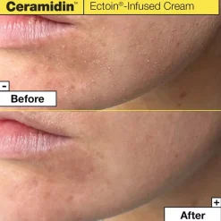 Dr. Jartu002B Ceramidin Feuchtigkeitsspendende Gesichtscreme mit Ceramiden von Dr. Jart+ Online