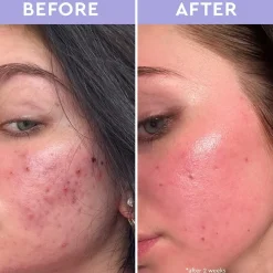 florence by mills Cleanse Spot a Spot Exfoliating Blemish Solution von Hot