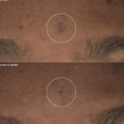 Clinique Even Better Clinical Brightening Moisturizer