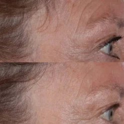 Perricone MD Cold Plasma Plus+ The Essence von Discount