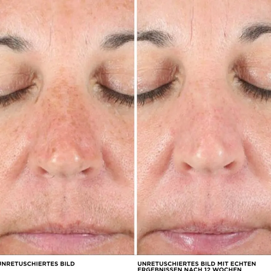 it Cosmetics Concealer Bye Bye Dark Spots Concealer von Discount