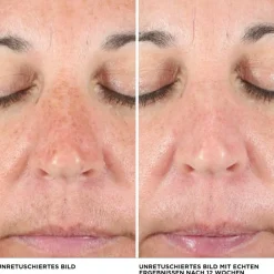 it Cosmetics Concealer Bye Bye Dark Spots Concealer von Discount