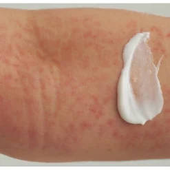 DADO SENS EXTRODERM HAUTBALSAM - bei trockener Haut und Neurodermitis von