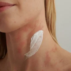 DADO SENS EXTRODERM INTENSIVCREME - bei  trockener Haut und Neurodermitis von