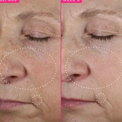 Farmacy Beauty Brighten Up 3% TXA Dark Spot Toner