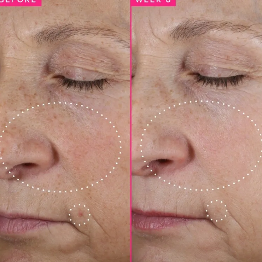 Farmacy Beauty Brighten Up 3% TXA Dark Spot Toner