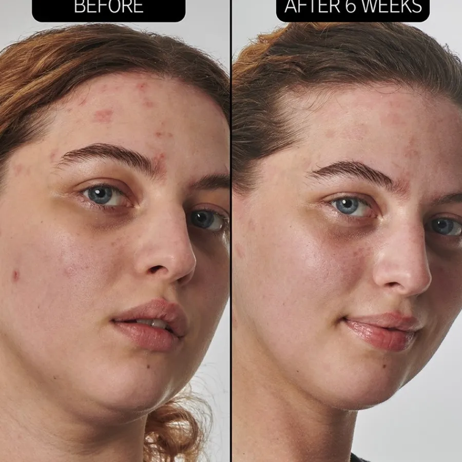 The INKEY List Feuchtigkeitscremes SuperSolutions 10% Urea Moisturizer von Hot