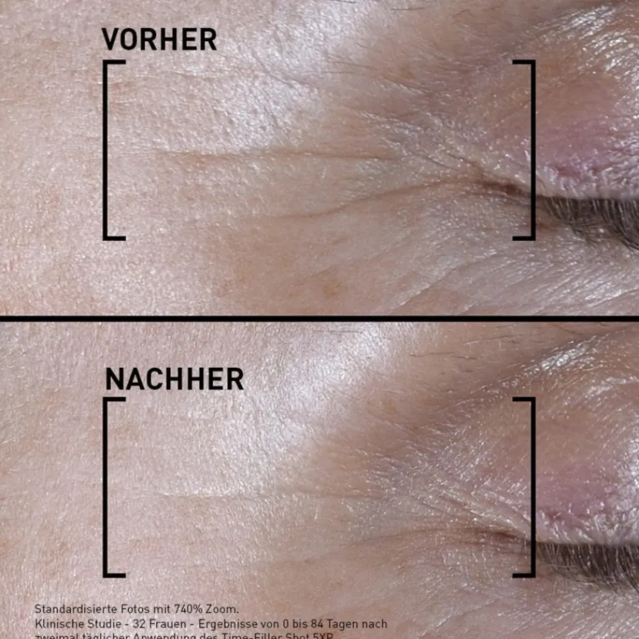 Filorga Time-Filler Shot 5XP