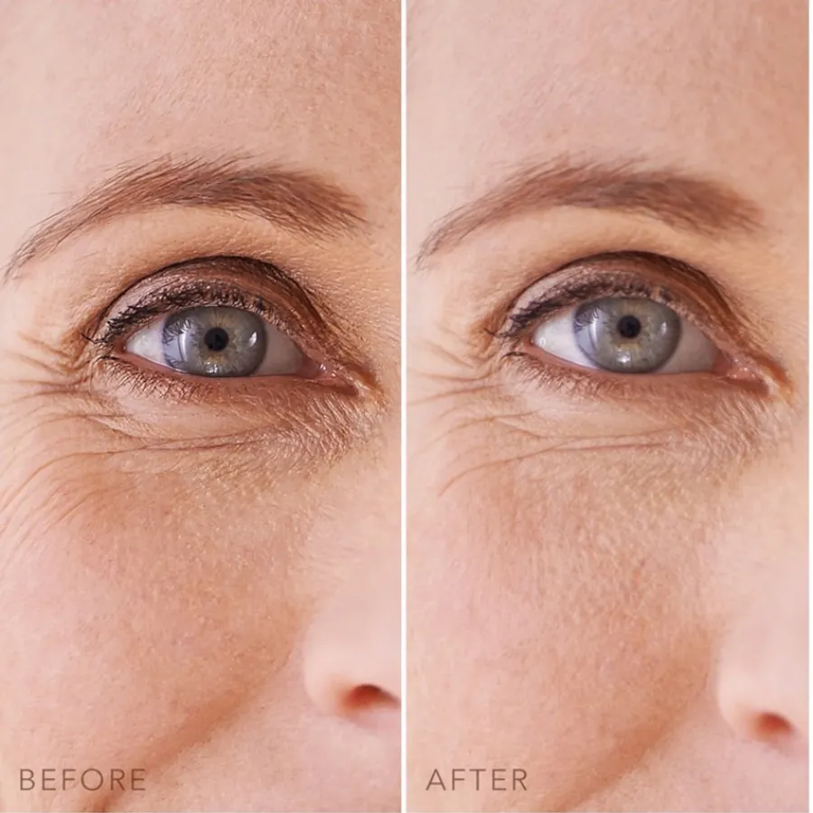 Foreo Hydrating Hydrogel Eye Mask Sale