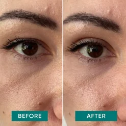 APRICOT Gesicht Eyelid Lifting Tapes von