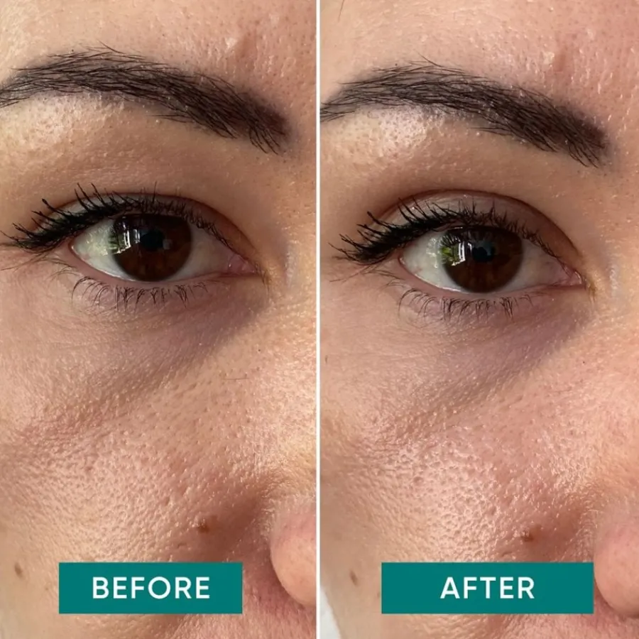 APRICOT Gesicht Eyelid Lifting Tapes von