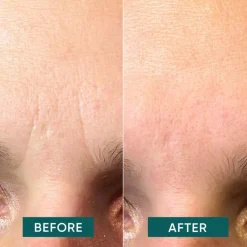 APRICOT Gesicht Facial Patches Niacinamide - it’s a skin-vestment von Sale