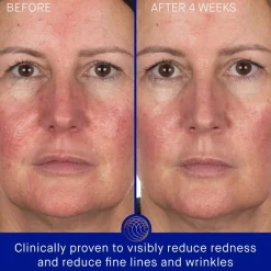 Augustinus Bader Gesicht Hydrogel Face Mask von