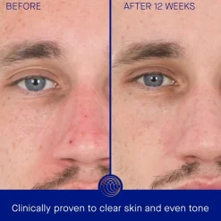 Augustinus Bader Gesicht The Retinol Serum von