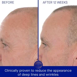 Augustinus Bader Gesicht The Retinol Serum von