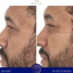 Augustinus Bader Gesicht The Retinol Serum von