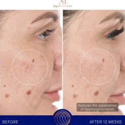 Augustinus Bader Gesicht The Retinol Serum von