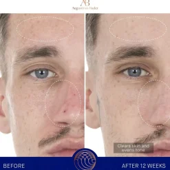 Augustinus Bader Gesicht The Retinol Serum von