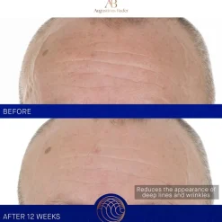 Augustinus Bader Gesicht The Retinol Serum von