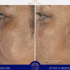 Augustinus Bader Gesicht The Serum Nomad Nachfüllung von