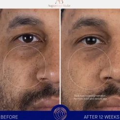 Augustinus Bader Gesicht The Serum Nomad Nachfüllung von