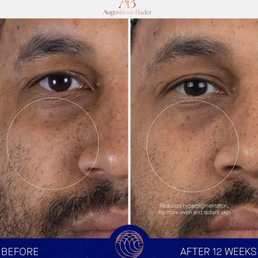 Augustinus Bader Gesicht The Serum Nomad Nachfüllung von