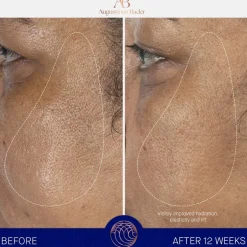 Augustinus Bader Gesicht The Serum von Clearance