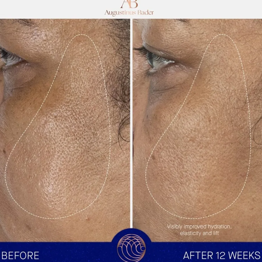 Augustinus Bader Gesicht The Serum von Clearance