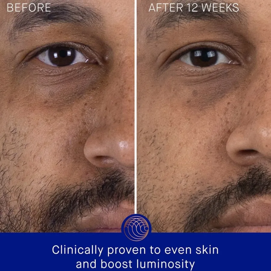 Augustinus Bader Gesicht The Serum von Clearance