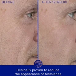 Augustinus Bader Gesicht The Serum von Clearance