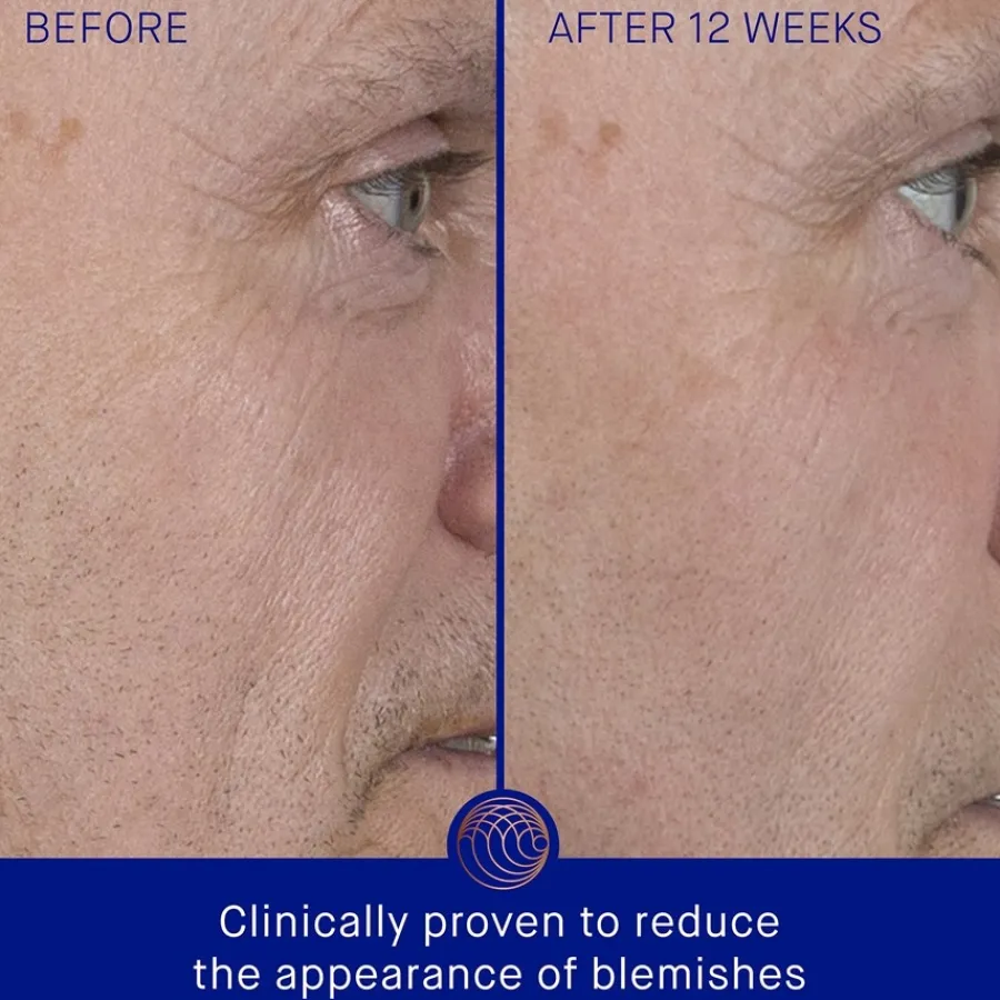 Augustinus Bader Gesicht The Serum von Clearance