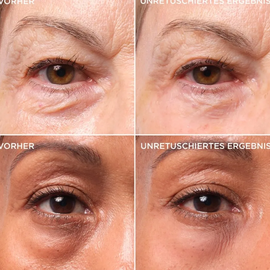 it Cosmetics Bye Bye Under Eye Bags