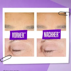 Kiehlu0027s Kiehl's Retinol Skin-Renewing Daily Micro-Dose Serum Discount