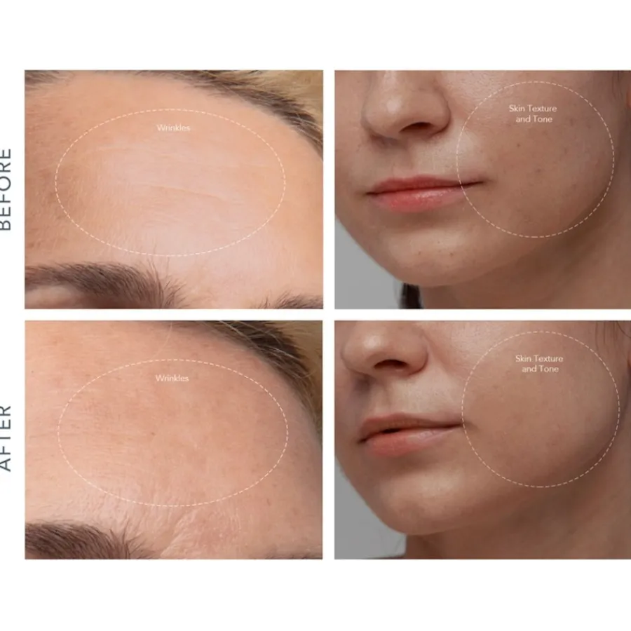 Foreo KIWI derma von