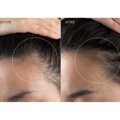 FAQ Swiss Kopfhautpflege FAQ™ 301 - LED Hair Strengthening Scalp Massager von Sale