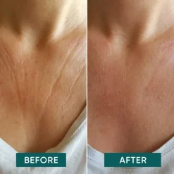 APRICOT Körper Decolleté Pad mit Vitamin C - décolleté delight von Outlet