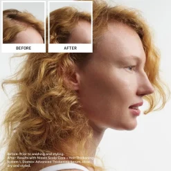 Nioxin Naturbelassenes, dezent dünner werdendes Haar Scalp Therapy Revitalising Conditioner Natural Hair Progressed Thinning von