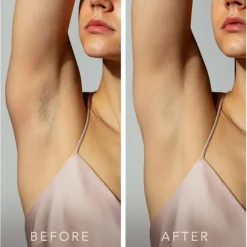 Foreo PEACH 2 IPL-Haarentfernungsgerät Mint von