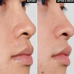 The INKEY List Peeling PHA Toner von