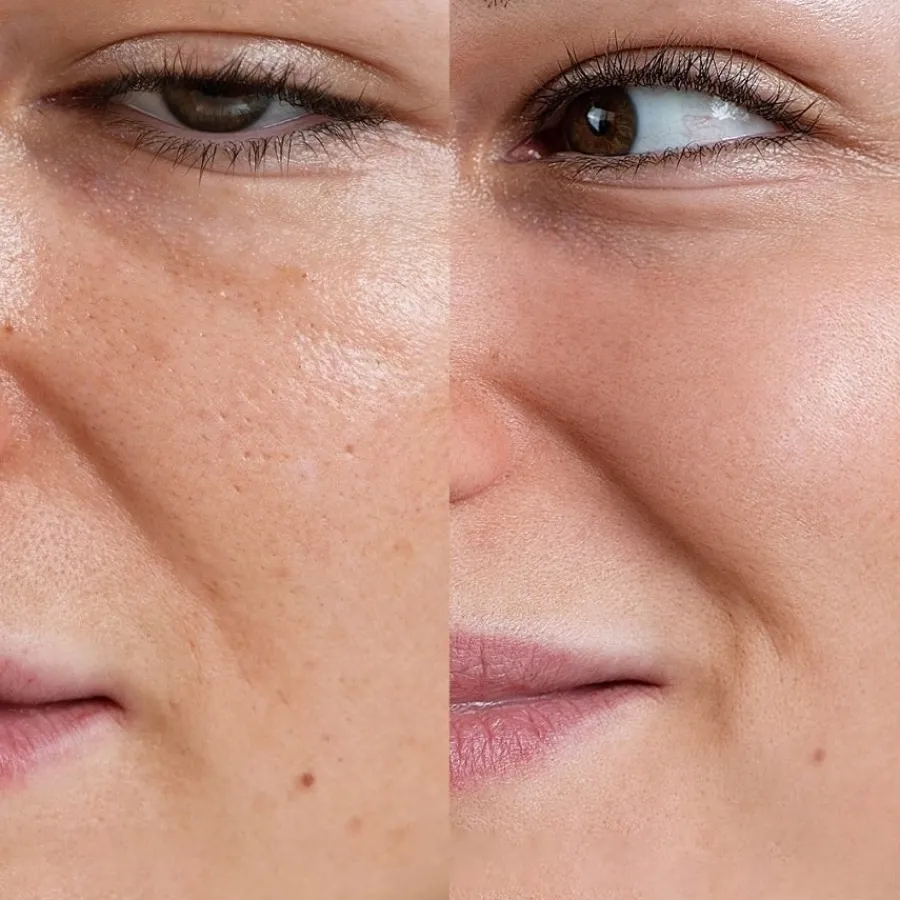 Rosental Organics Peeling Skin Exfoliating Peeling von Discount