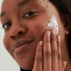 DADO SENS PURDERM EFFEKTCREME - bei unreiner Haut von