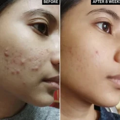 The INKEY List Reiniger Salicylic Acid Cleanser von