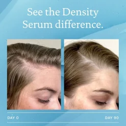 Living Proof Scalp Care Density Serum von